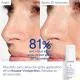 CAUDALIE Vinoperfect - Mousse Micro-Peeling Eclat 100ml - Illustration n&deg;4